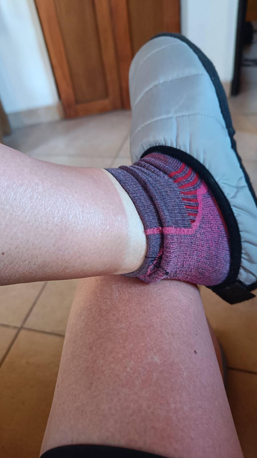 Sunburnt legs